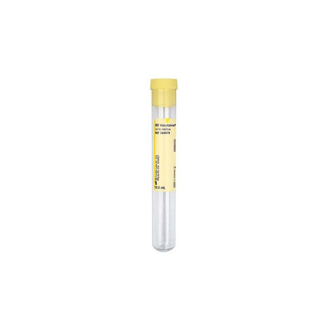 BD Plus Plastic Round-Bottom Tube for Urinalysis - BeHope