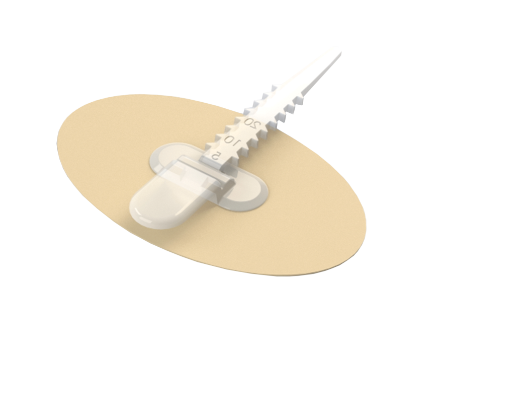 Bx/30 Cathgrip Single Strap, Extra Small, No Barrier Wipes - Bilingual