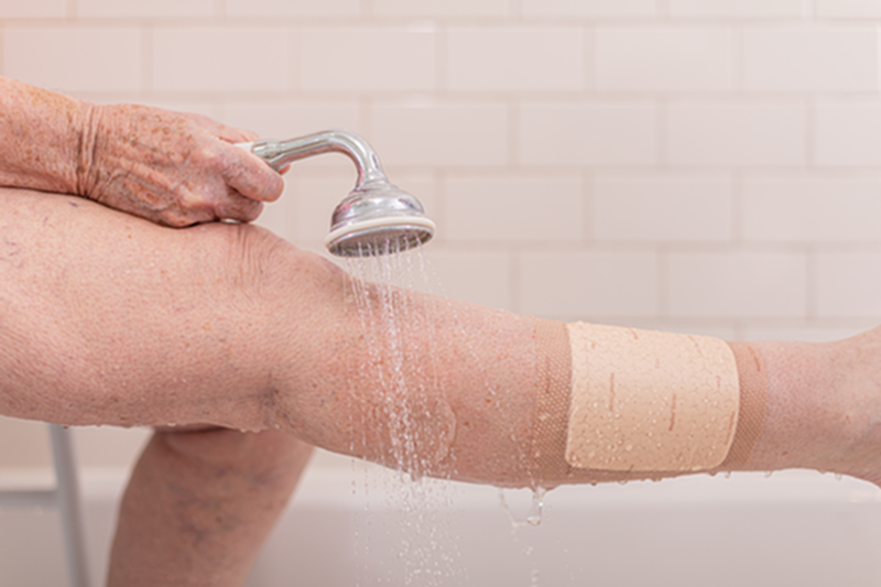 Bx/10 Mepilex Border Flex 10X10Cm (4X4" ) - BeHope