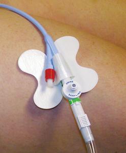 Catheter Accessories