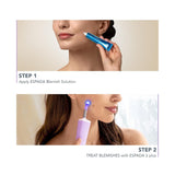 Acne Treatment ESPADA™ 2 plus