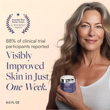 Hand and Body Moisturizer Skintensive® Bruise Cream 4 oz. Jar Unscented Cream