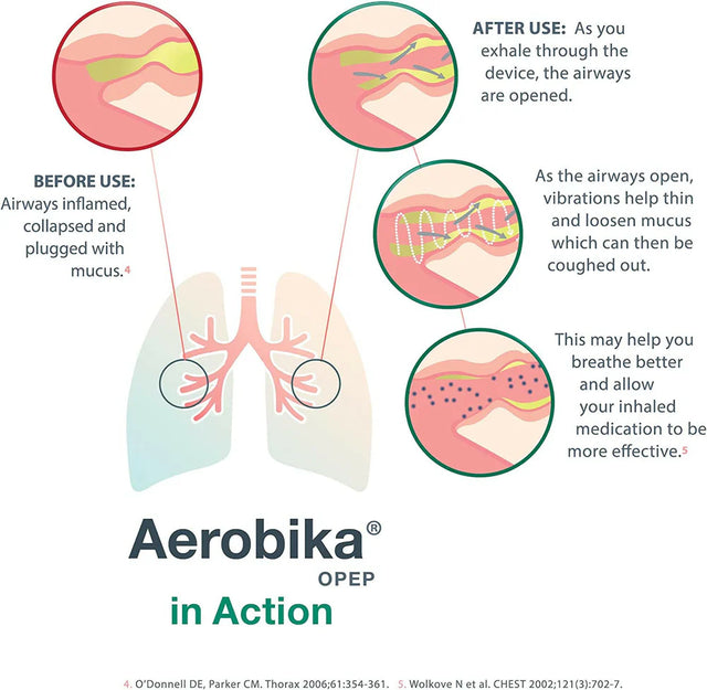 Aerobika Opep Device - BeHope